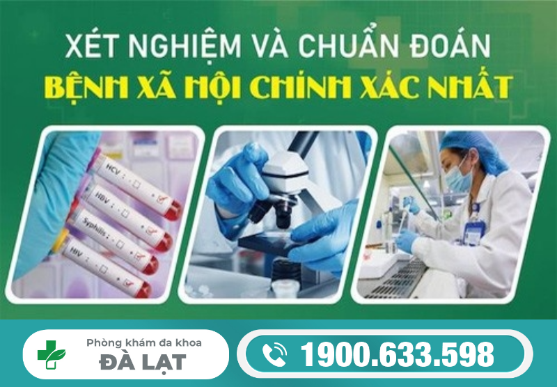 Hình ảnh minh họa
